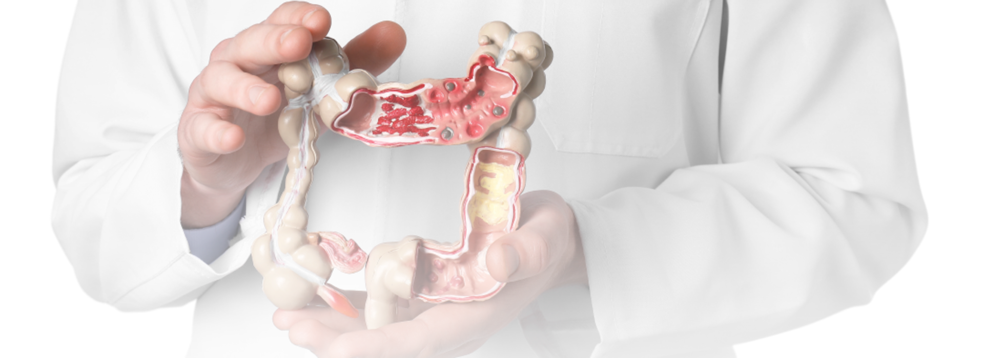 Banner de Causas, síntomas y prevención del cáncer de colon