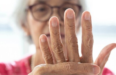 Banner Actividad física y ejercicio en el paciente con artitis reumatoide