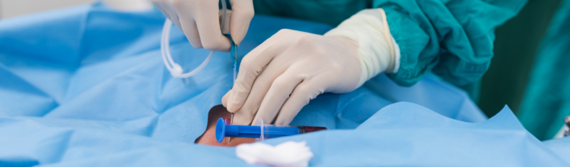 Terapia endovascular